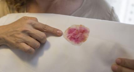 KAKO DA UKLONITE FLEKE SA BELOG STOLNJAKA